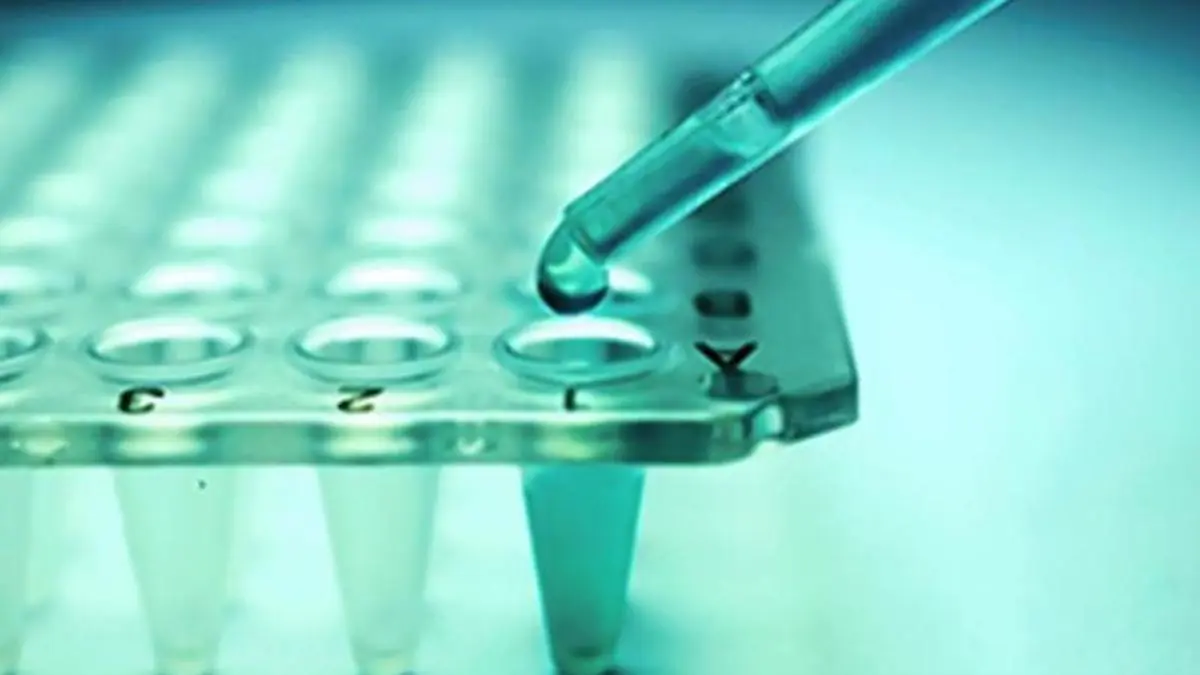 Odisha combines screening, diagnosis, treatment to deal with sickle cell disease Odisha combines screening, diagnosis, treatment to deal with sickle cell disease