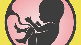 A stillbirth is when a baby is born without signs of life after 28 weeks of pregnancy