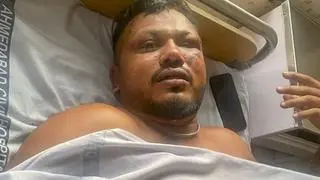 Vishwash Kumar Ramesh, the lone survivor of the Air India plane crash, receives treatment at a hospital in Ahmedabad, Thursday, June 12, 2025. The Ahmedabad-London Air India flight carrying 242 passengers crashed moments after taking off from the Ahmedabad airport.