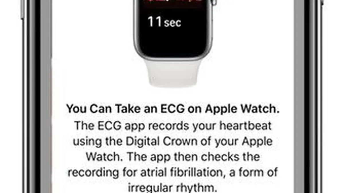 Ecg app not on apple watch hot sale